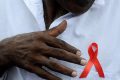 Le président exécutif des associations de lutte contre le VIH-Sida, Thierry Mbome Nyami s’est insurgé contre la désertion des médecins dans les structures de prise en charge. © Franceinfo