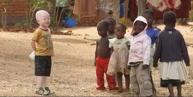 6e Journée internationale de sensibilisation à l'albinisme