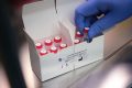 L’entreprise Arise a fait un don Gabon de kits permettant la réalisation de 20 000 tests de diagnostic du Covid-19. © The Straits Times
