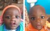 Une vaste opération chirurgicale pour les enfants souffrant de fentes labio-palatines est annoncée au CHU de la Fondation Jeanne Ebori, à Libreville. © D.R.