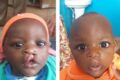 Une vaste opération chirurgicale pour les enfants souffrant de fentes labio-palatines est annoncée au CHU de la Fondation Jeanne Ebori, à Libreville. © D.R.