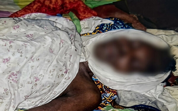 Moanda : une femme épileptique retrouvée morte dans sa chambre